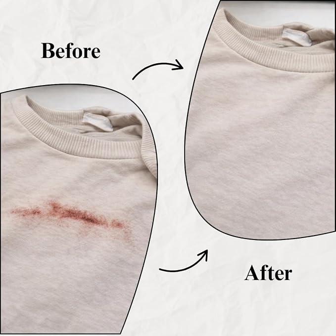 Blood Stain Remover for Clothes (10.14oz) | For Mattress, Sheets & Fabric – Enzyme Formula for Fresh, Dried & Menstrual Period Blood Stains