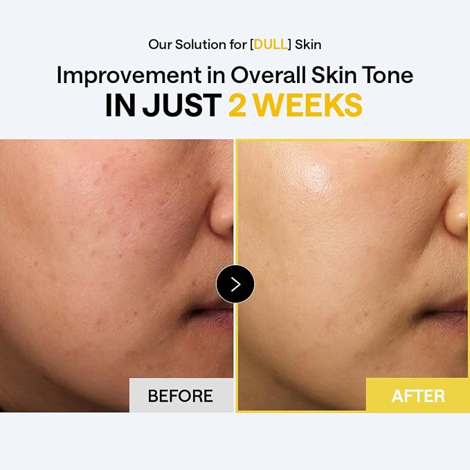MEDIHEAL Vitamin C Bright Toning Toner Pads, Uneven Skin Toning (100 Count) | with Niacinamide, Glutathione | Dark Spot, Radiance, Skin Tone Care | Plastic-Free Vegan Pads | Korean Derma Toner Pads