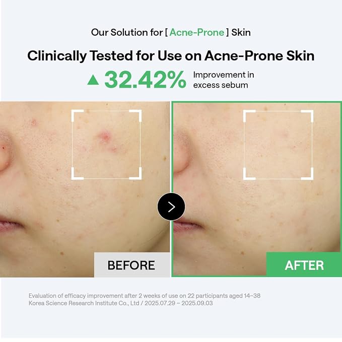 MEDIHEAL Teatree Trouble Calming Toner Pads, Quick Soothing (100 Count) | with Tea Tree Leaf Oil | for Sensitive & Acne-Prone Skin| Non-comedogenic | Plastic-Free Vegan Pads | Korean Derma Toner Pads