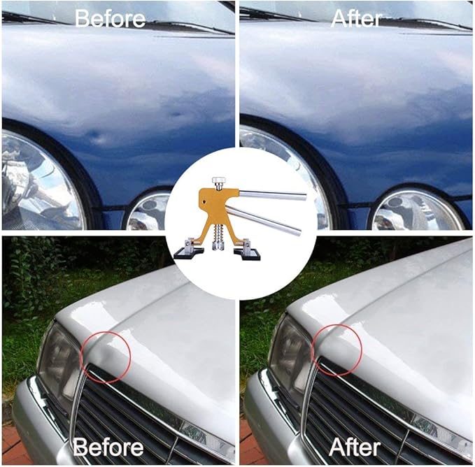 GLISTON Auto Dent Puller Kit - Adjustable Golden Dent Remover Tools Paintless Dent Repair Kit Dent Lifter Puller for Car Large & Small Ding Hail Dent Removal