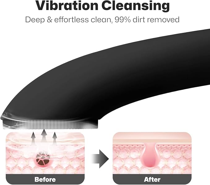 PRITECH Facial Cleansing Brush, Rechargeable Silicone Face Scrubber with Heat Massage End, Vibrating Exfoliator Scrubber for Deep Cleaning, Waterproof Face Brush for Women and Men (Black)