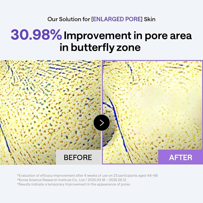 MEDIHEAL PDRN Lifting Toner Pads, Pore & Wrinkle Care (100 Count) | with Niacinamide, Glutathione | Pore Minimizing, Firming, Skin Renewal | Stretchable Pads | Korean Derma Toner Pads