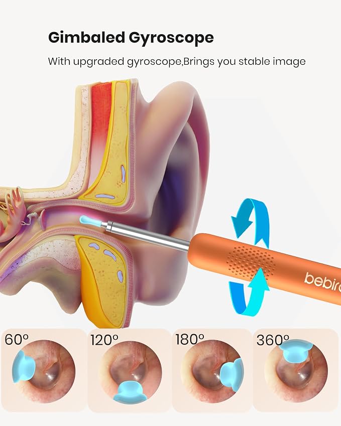 BEBIRD R1 Wax Removal Tool for Ear - Spade Ear Canal Cleaner with Camera 1080P Earscope, Wax Remove Ear Picker with Vari Replacement Tips, Camera with 6LED Light, Orange