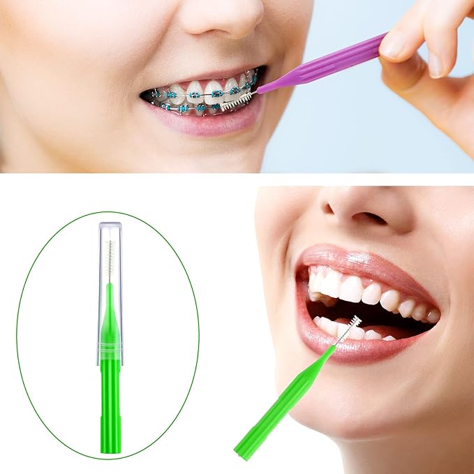 Patelai 100 Count Interdental Brush Set, Soft Braces Cleaner Picks with Cap, Multi Size Teeth Gap Cleaning Tool for Orthodontic Care Bridge Implant Travel Kit(Stylish Colors)