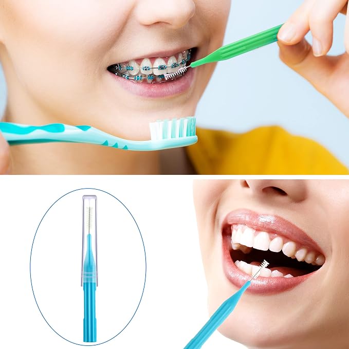 Patelai 100 Count Interdental Brush Set, Soft Braces Cleaner Picks with Cap, Multi Size Teeth Gap Cleaning Tool for Orthodontic Care Bridge Implant Travel Kit(Light Blue, Pink, Yellow, Light Green)