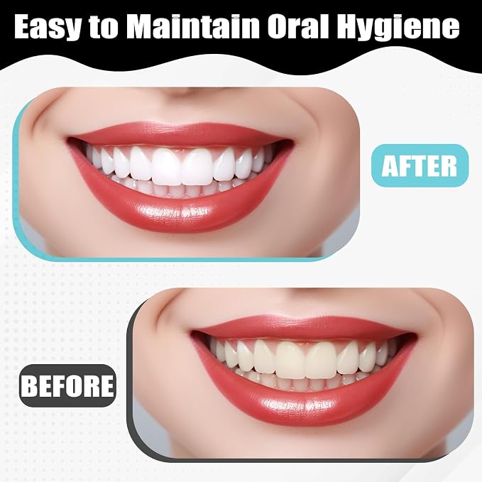 JJUNW Dental Tooth Stain Removers, Dental Plaque Tool Tartar Eraser Polisher Professional Teeth Whitening Polishing Cleaning Kit for Teeth Whitening Polishing Oral Care(8PCS)