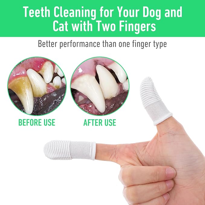 YUIANLB 40 Pcs Pet Dental Care Kit Finger Toothbrush Oral Cleaning Wipes | Soft Washable Fabric, Freshens Breath, Reduces Plaque Tartar, Complete Oral Hygiene Set, for Puppies Kittens, at Home
