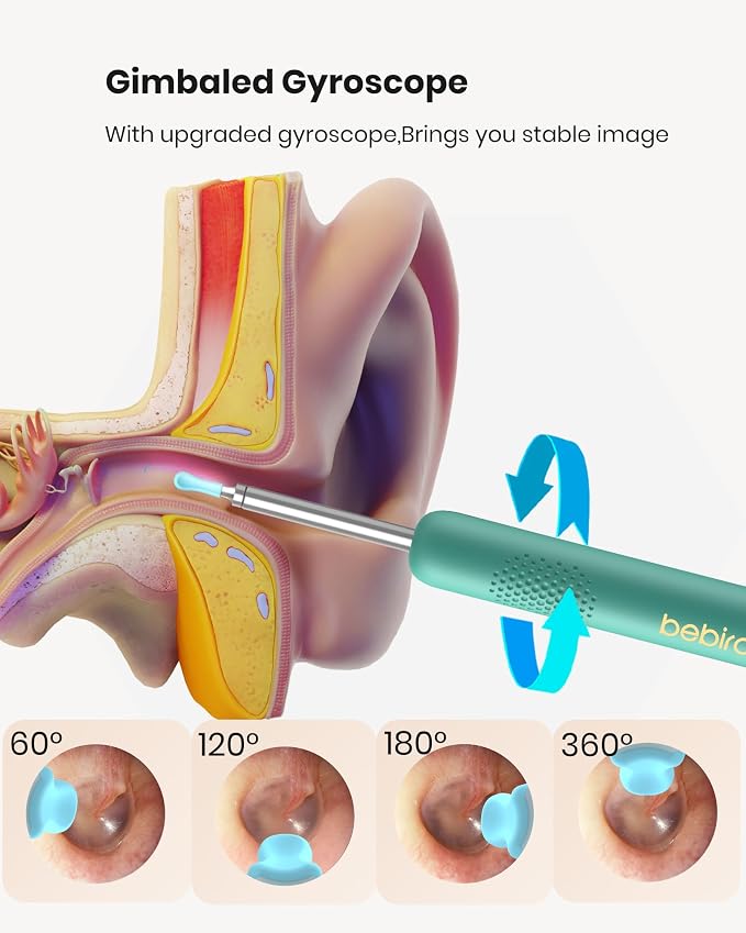BEBIRD R1 Wax Removal Tool for Ear - Spade Ear Canal Cleaner with Camera 1080P Earscope, Wax Remove Ear Picker with Vari Replacement Tips, Camera with 6LED Light, Green