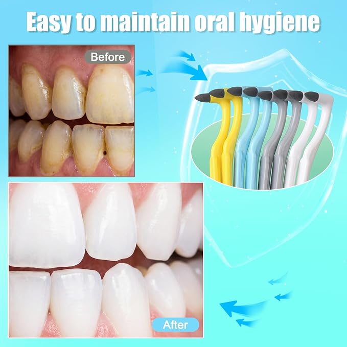 8PCS Tooth Stain Remover Dental Plaque Tartar Eraser Tool Kit, Teeth Cleaning Polisher with Dental Picks, Oral Care Teeth Whitening Cleaning Tools