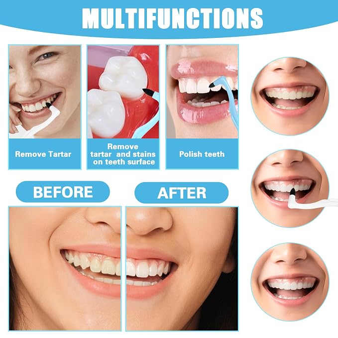 8 Pcs Tooth Stain Eraser Tartar Polisher Stain Removers Dental Plaque Tartar Eraser Plaque Tool Professional Dental Picks Cleaning Professional Tools Teeth Cleaning Kit for Oral Care White and Blue