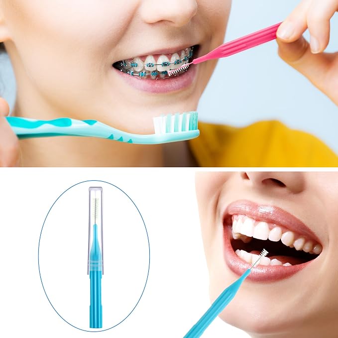 Patelai 100 Count Interdental Brush Set, Soft Braces Cleaner Picks with Cap, Multi Size Teeth Gap Cleaning Tool for Orthodontic Care Bridge Implant Travel Kit(Light Blue,Pink,Yellow,Orange)