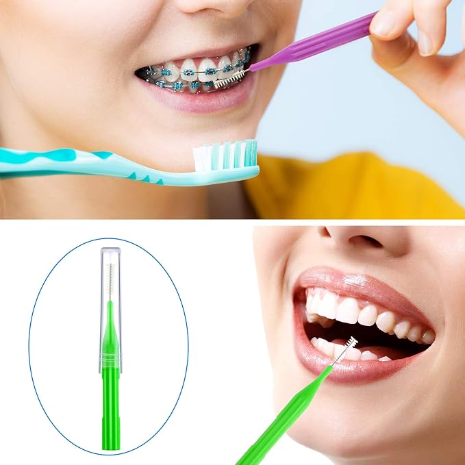 Patelai 100 Count Interdental Brush Set, Soft Braces Cleaner Picks with Cap, Multi Size Teeth Gap Cleaning Tool for Orthodontic Care Bridge Implant Travel Kit(Light Blue, Yellow, Gray, Purple, Green)