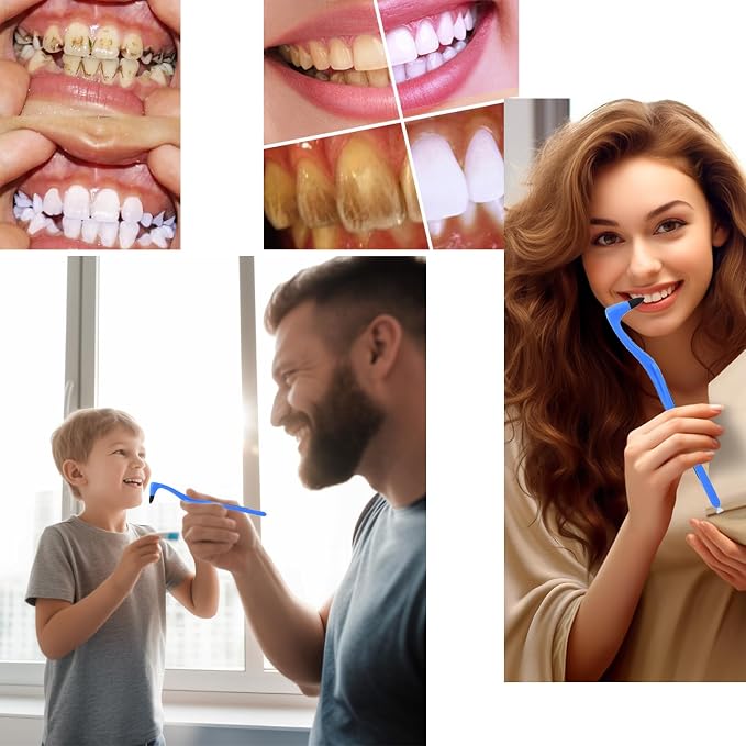 Tooth Stain Remover, Dental Plaque Tool, Tartar Eraser Polisher, Professional Teeth Whitening Polishing Cleaning Kit, Home Calculus Removal Effectively, NOT Electric Cleaner Brush/Dentist