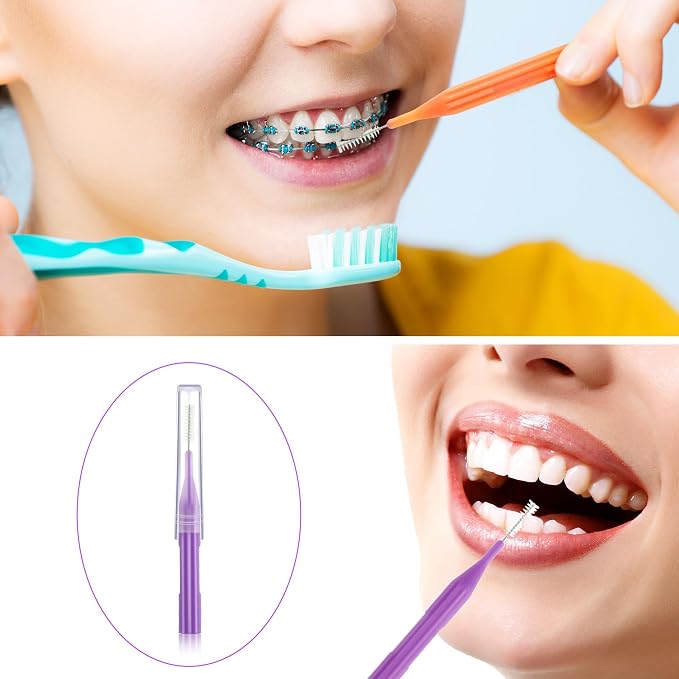 Patelai 100 Count Interdental Brush Set, Soft Braces Cleaner Picks with Cap, Multi Size Teeth Gap Cleaning Tool for Orthodontic Care Bridge Implant Travel Kit(Orange,Yellow, Light Blue, Purple, Grey)
