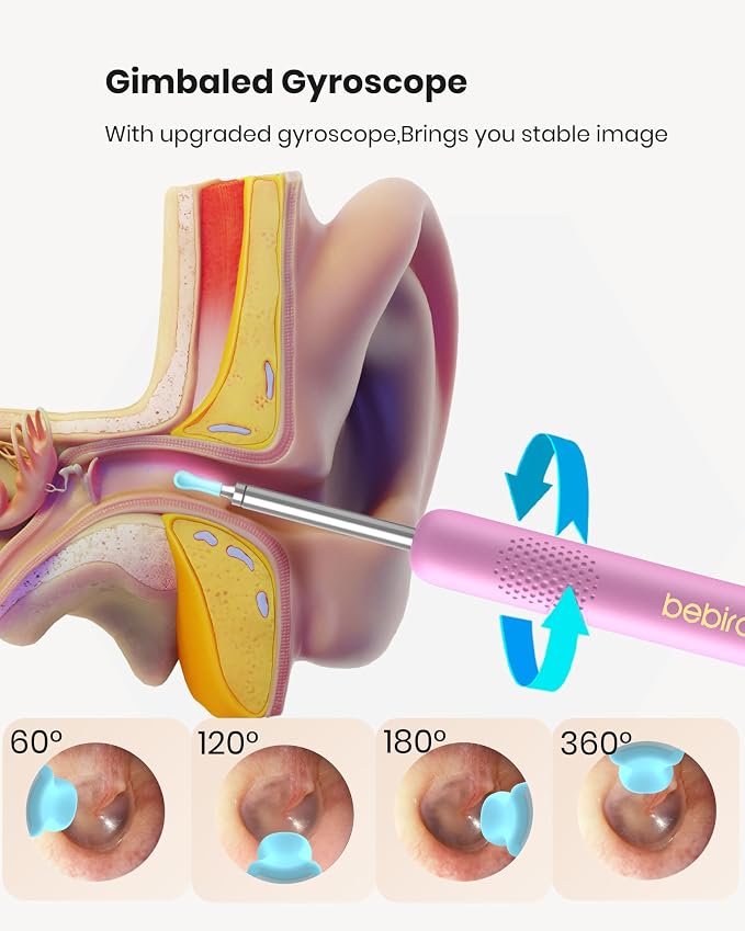 BEBIRD R1 Wax Removal Tool for Ear - Spade Ear Canal Cleaner with Camera 1080P Earscope, Wax Remove Ear Picker with Vari Replacement Tips, Camera with 6LED Light, Pink