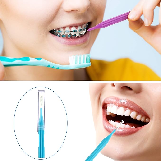 Patelai 100 Count Interdental Brush Set, Soft Braces Cleaner Picks with Cap, Multi Size Teeth Gap Cleaning Tool for Orthodontic Care Bridge Implant Travel Kit(Light Blue, Yellow, Gray, Purple)