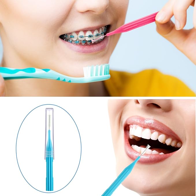 Patelai 100 Count Interdental Brush Set, Soft Braces Cleaner Picks with Cap, Multi Size Teeth Gap Cleaning Tool for Orthodontic Care Bridge Implant Travel Kit(Light Blue,Pink)