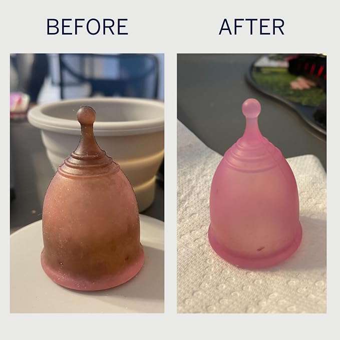 Pixie Cup Stain Remover - The Only Sterilizer Cleaner that Will Remove Stains On Your Reusable Menstrual Discs & Period Cups - Organic and Natural Ingredients for Feminine Care (5 Packets)