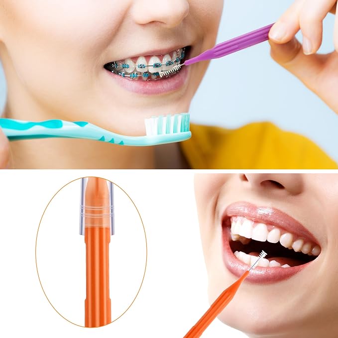 Patelai 100 Count Interdental Brush Set, Soft Braces Cleaner Picks with Cap, Multi Size Teeth Gap Cleaning Tool for Orthodontic Care Bridge Implant Travel Kit(Orange, Purple)