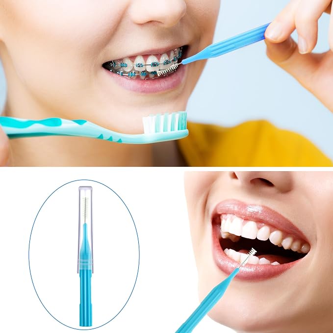 Patelai 100 Count Interdental Brush Set, Soft Braces Cleaner Picks with Cap, Multi Size Teeth Gap Cleaning Tool for Orthodontic Care Bridge Implant Travel Kit(Light Blue)